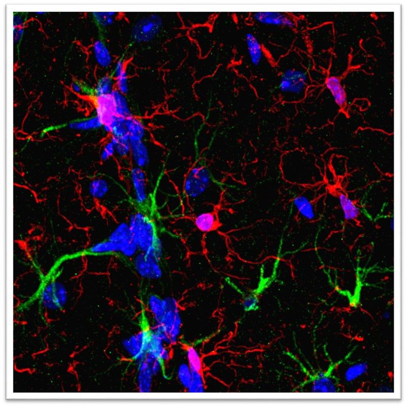 Microglia in transgenic brain 