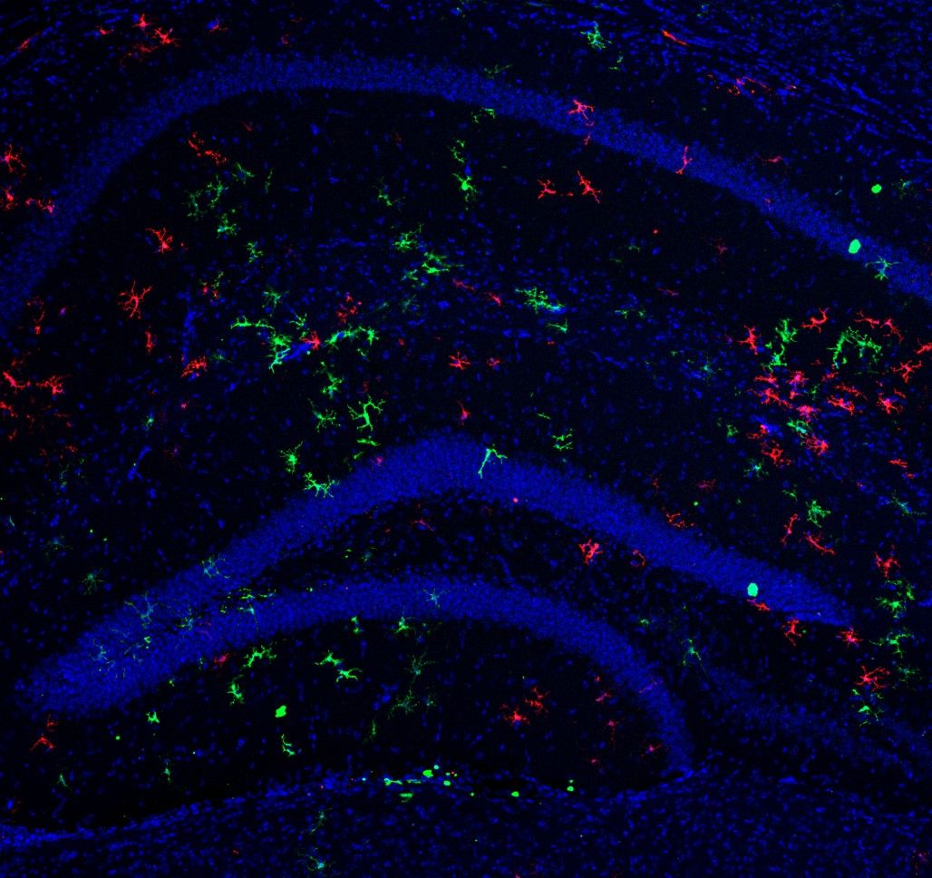 Microglia Repopulation 