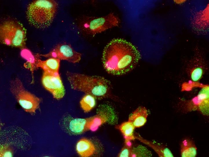Uptake of tau fibrils (pink) by human microglia (green)